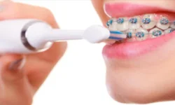 Brossage des dents