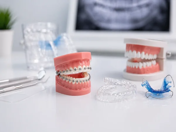 Traitement Orthodontie OrthoMennecy